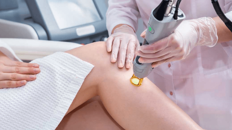 نکات مراقبتی قبل از لیزر موهای زائد | بهترین مطب زیبایی اصفهان