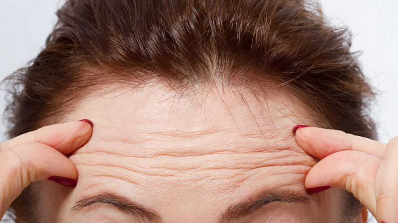 پیشگیری از بروز چروک پیشانی | تزریق ژل و بوتاکس اصفهان