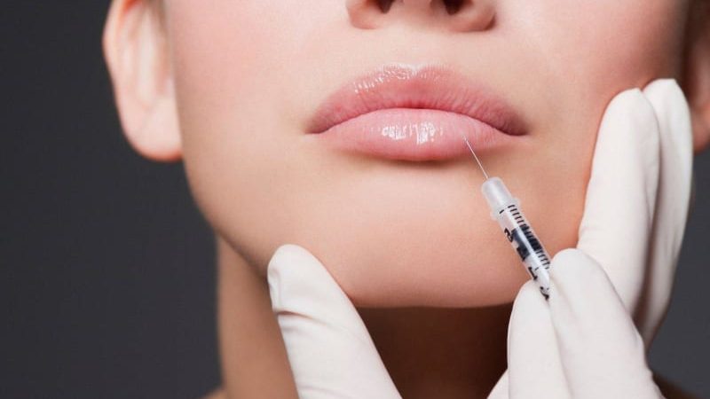 ژل پروفایلو | تزریق ژل و بوتاکس اصفهان