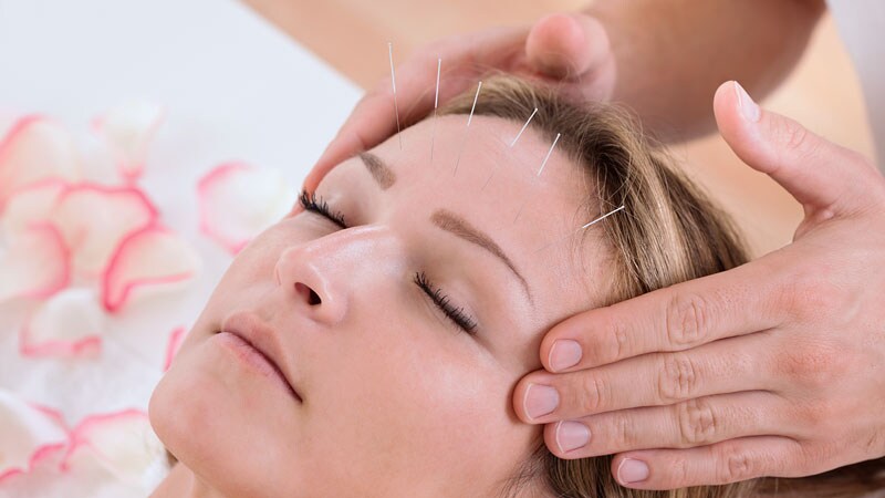 آشنایی با روش های مختلف طب سوزنی | بهترین مطب زیبایی اصفهان