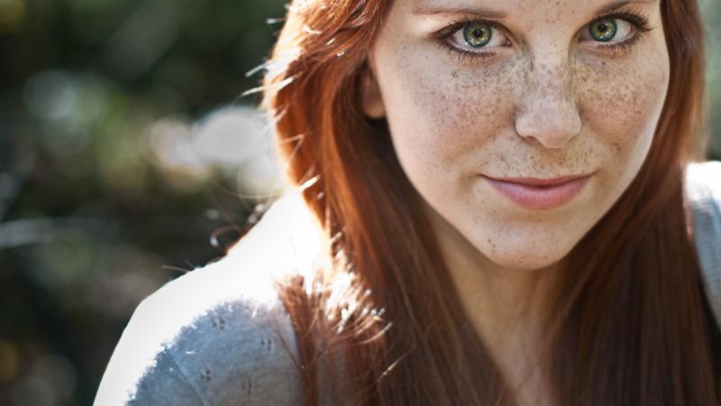 نکات مراقبتی برای کک و مک | تزریق ژل و بوتاکس اصفهان