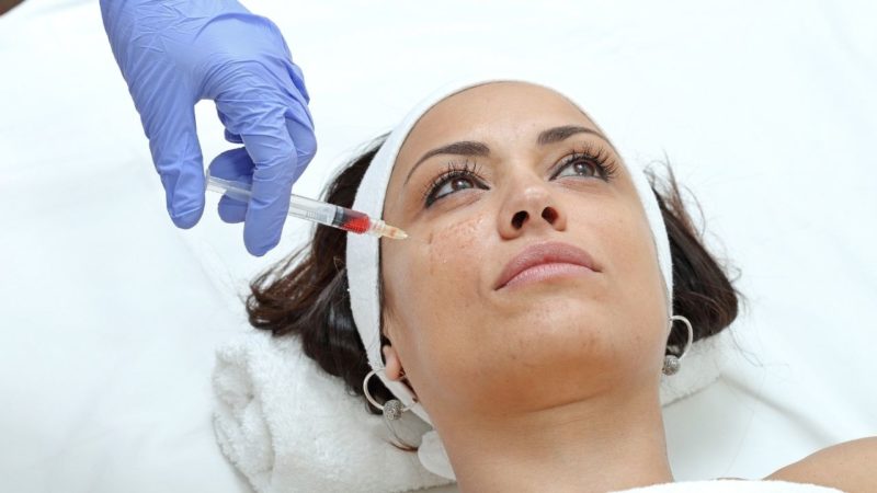 مناطق قابل تزریق فیلرهای زیبایی | تزریق ژل و بوتاکس اصفهان