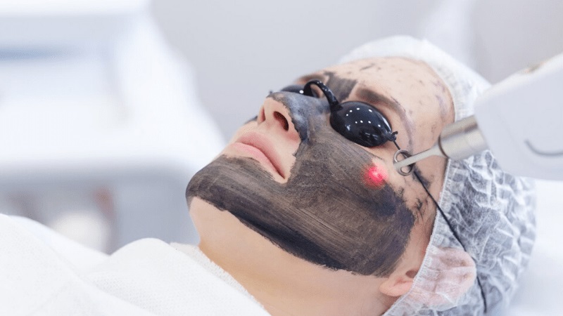 رفع چین و چروک پوست با لیزر فرکسل | تزریق ژل و بوتاکس اصفهان