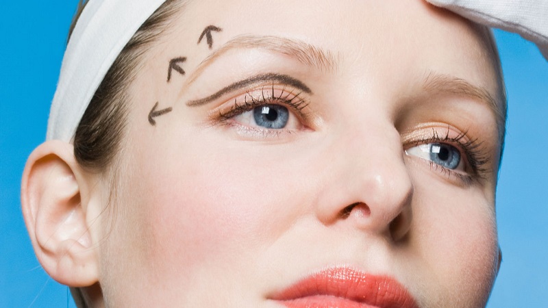 روش های مختلف لیفت ابرو | تزریق ژل و بوتاکس اصفهان