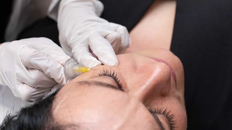 مراقبت های قبل و بعد از کربوکسی تراپی دور چشم | بهترین مطب زیبایی اصفهان