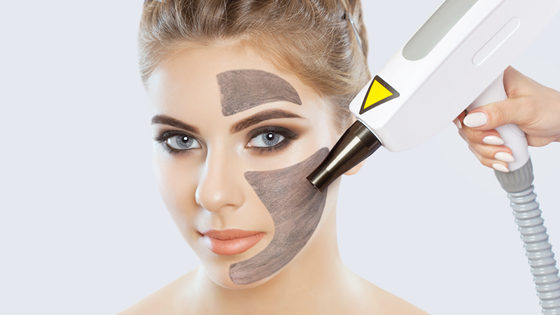 لایه برداری پوست به روش کربن پیل با لیزر | بهترین مطب زیبایی اصفهان