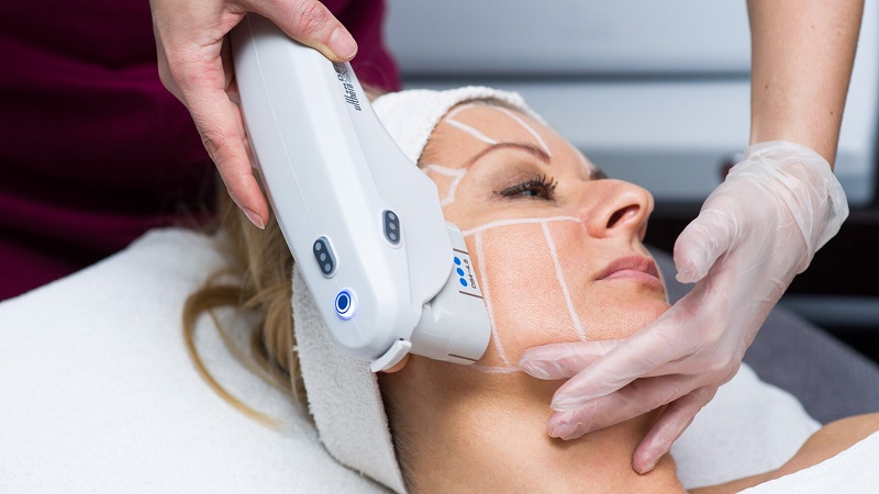 میزان ماندگاری انواع لیزر جوانسازی | تزریق ژل و بوتاکس اصفهان