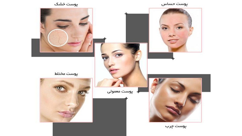 معرفی تخصصی انواع پوست| دکتر مهناز کبیریان