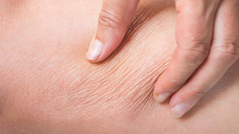 دهیدراته شدن پوست | بهترین مطب زیبایی اصفهان | دکتر مهناز کبیریان |