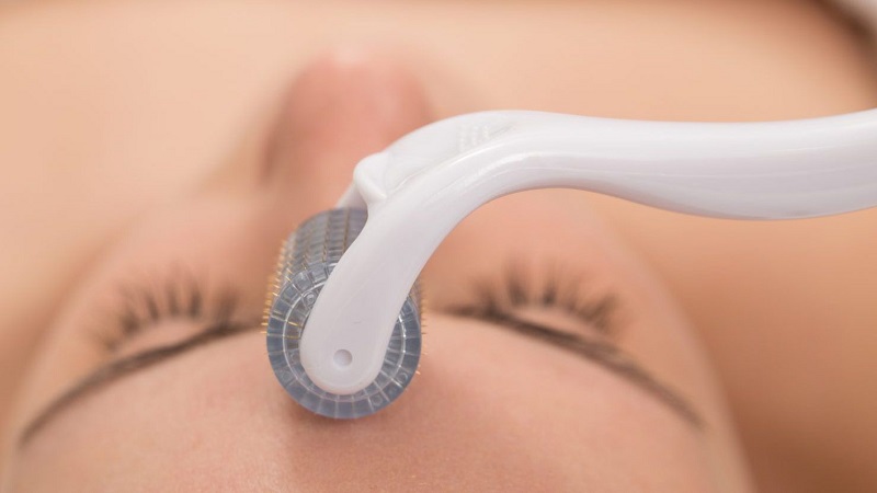 چگونگی استفاده از درمارولر| بهترین مطب زیبایی اصفهان | دکتر مهناز کبیریان |