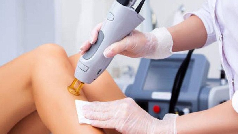 فرآیند لیزر موهای زائد | دکتر مهناز کبیریان