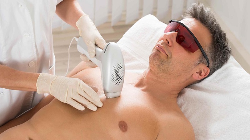 تفاوت تعداد شات لیزر در زنان و مردان | بهترین مطب زیبایی اصفهان - تزریق ژل و بوتاکس اصفهان