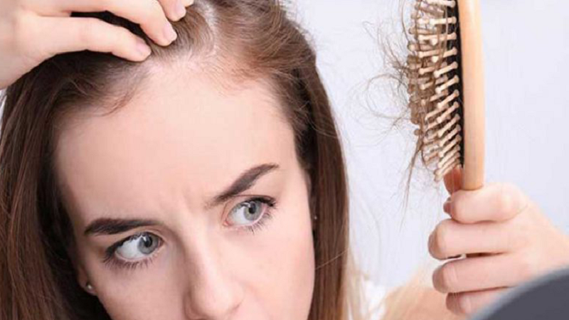 جلوگیری از ریزش مو ارثی | بهترین مطب زیبایی اصفهان - تزریق ژل و بوتاکس اصفهان