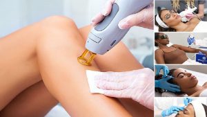 جلوگیری از تیرگی پوست بعد از لیزر موهای زائد | بهترین مطب زیبایی اصفهان - تزریق ژل و بوتاکس اصفهان