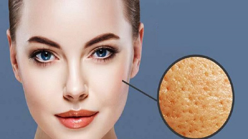 علت بزرگ شدن منافذ پوست چیست؟ | بهترین مطب زیبایی اصفهان - تزریق ژل و بوتاکس اصفهان