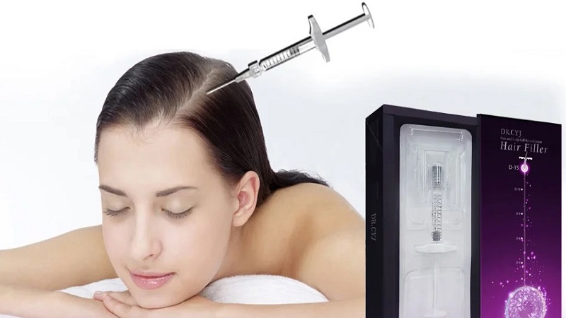 کاربرد و محدودیت تزریق هیر فیلر به پوست سر | بهترین مطب زیبایی اصفهان - تزریق ژل و بوتاکس اصفهان