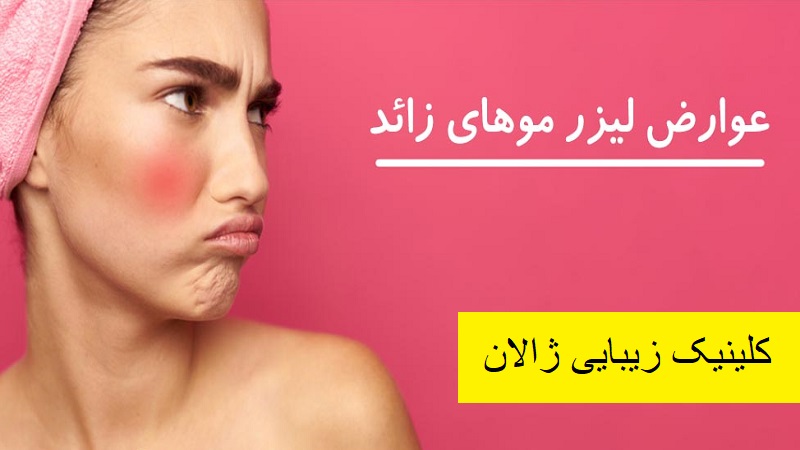 آیا لیزر موهای زائد عوارض دارد؟ | بهترین مطب زیبایی اصفهان - تزریق ژل و بوتاکس اصفهان