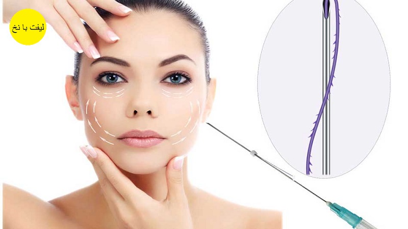 لیفت با نخ | بهترین مطب زیبایی اصفهان - تزریق ژل و بوتاکس اصفهان