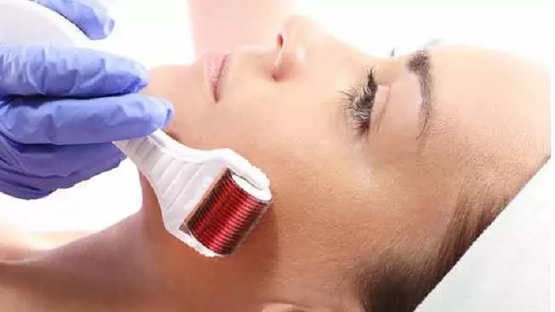 روش درمان منافذ باز پوست با میکرونیدلینگ | بهترین مطب زیبایی اصفهان - تزریق ژل و بوتاکس اصفهان