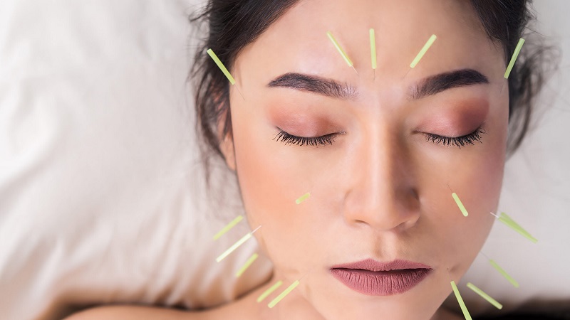 طب سوزنی صورت | بهترین مطب زیبایی اصفهان - تزریق ژل و بوتاکس اصفهان