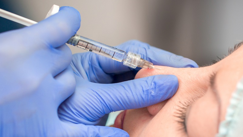 مراحل انجام تزریق فیلر به بینی | بهترین مطب زیبایی اصفهان - تزریق ژل و بوتاکس اصفهان