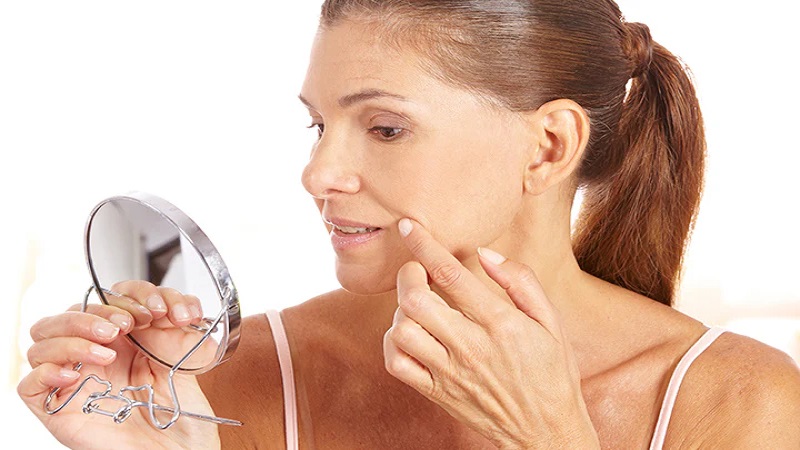 از بین بردن خط خنده | بهترین مطب زیبایی اصفهان - تزریق ژل و بوتاکس اصفهان