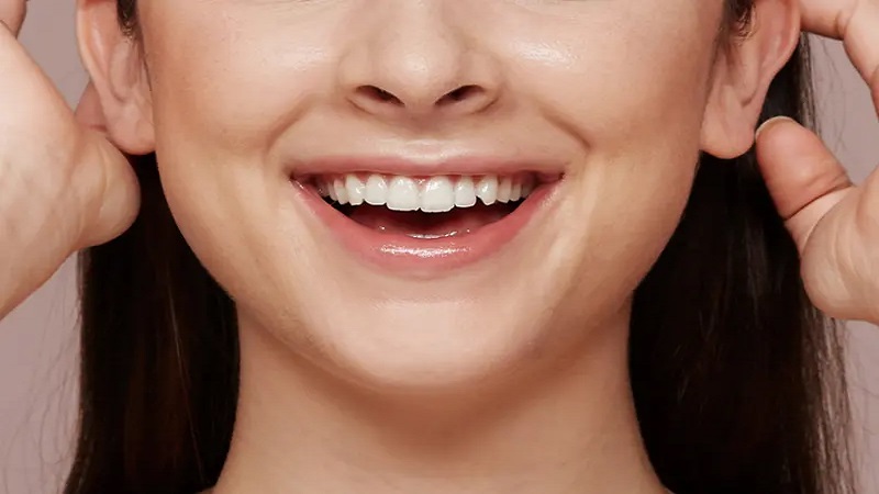 از بین بردن خط خنده | بهترین مطب زیبایی اصفهان - تزریق ژل و بوتاکس اصفهان