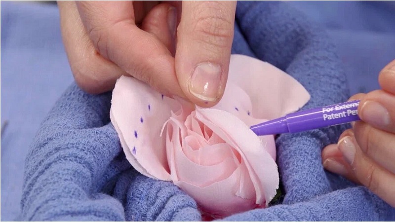 عوامل تاثیرگذار بر هزینه عمل لابیاپلاستی | بهترین لابیاپلاستی اصفهان | دکتر مهناز کبیریان