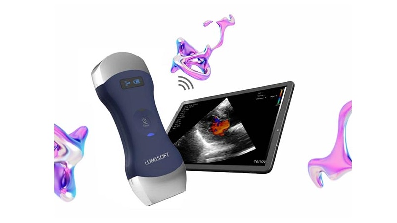 افزایش دقت تزریق فیلر ژنیتال با سونوگرافی | فیلر ژنیتال اصفهان | دکتر مهناز کبیریان