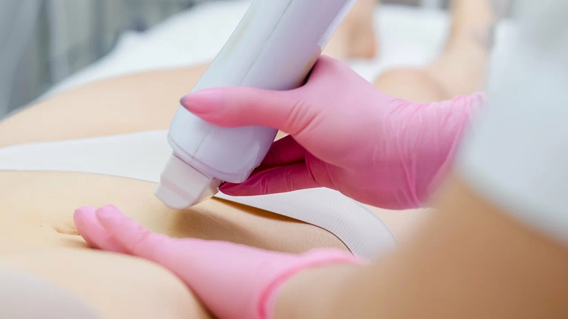 جوانسازی ژنیتال با لیزر جوانسازی اصفهان | بهترین لابیاپلاستی اصفهان | دکتر مهناز کبیریان