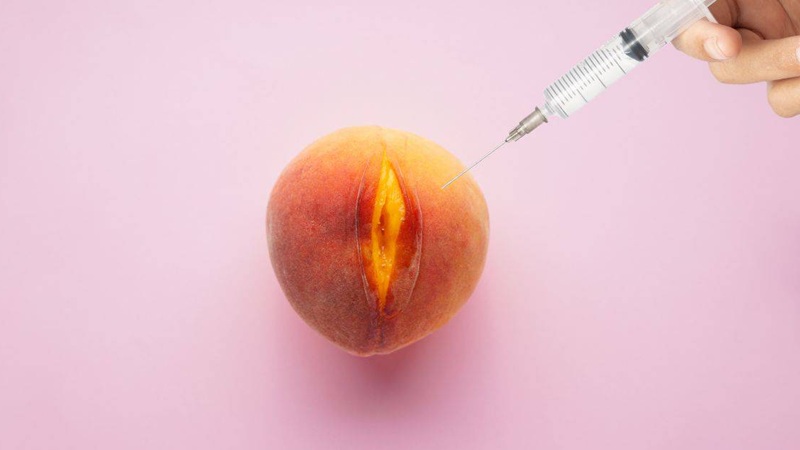 فیلر ژنیتال اصفهان | بهترین لابیاپلاستی اصفهان | دکتر مهناز کبیریان