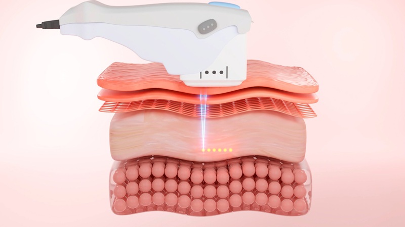 هایفو ژنیتال اصفهان | فیلر ژنیتال اصفهان | دکتر مهناز کبیریان