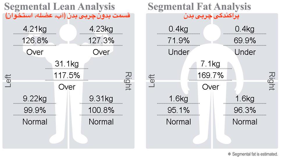 دستگاه اینبادی؛ چرا بدون آن لاغری ممکن نیست؟